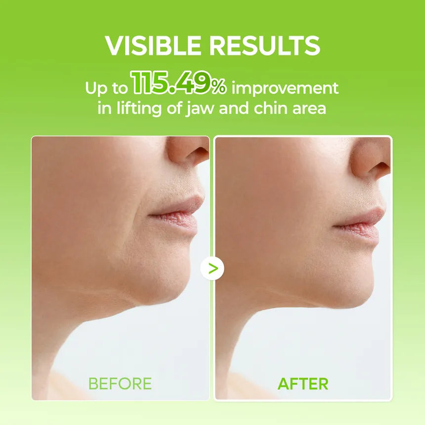 V-Shape Lift Mask