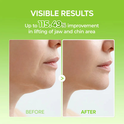 V-Shape Lift Mask